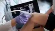 Ultraschalluntersuchung